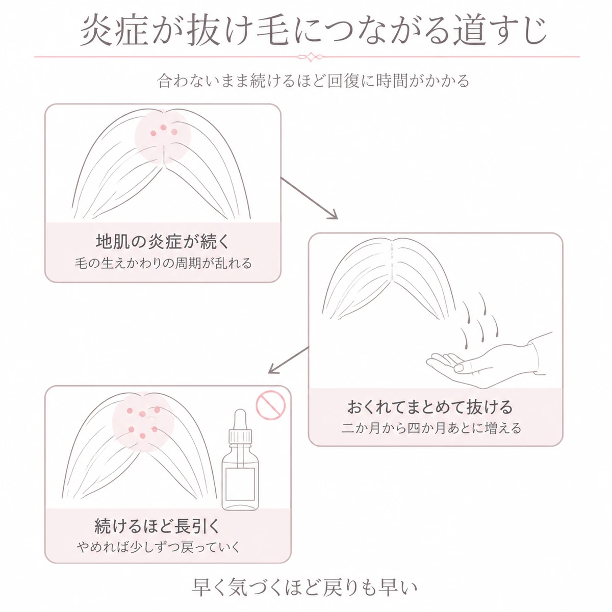 地肌の炎症からおくれてまとめて抜けるまでの進み方をジグザグに並べて描いたイラスト