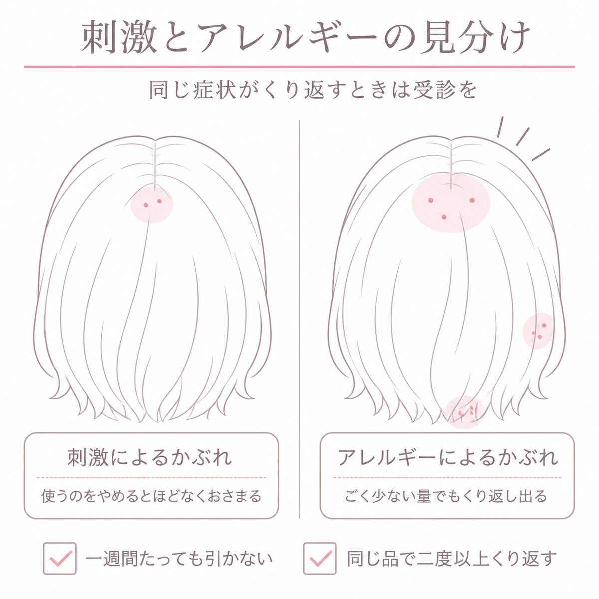 刺激によるかぶれとアレルギーによるかぶれの出方の違いと、受診を考える目安を並べた図解イラスト