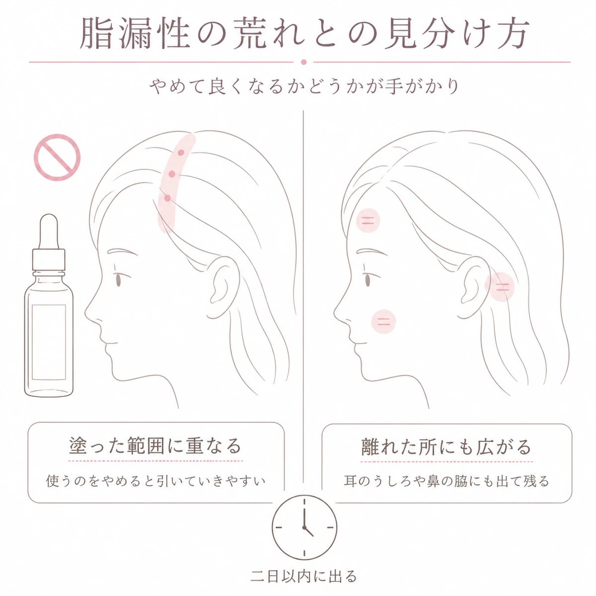 塗った範囲に出る反応と、耳のうしろや鼻の脇まで広がる荒れを左右に並べて比べたイラスト