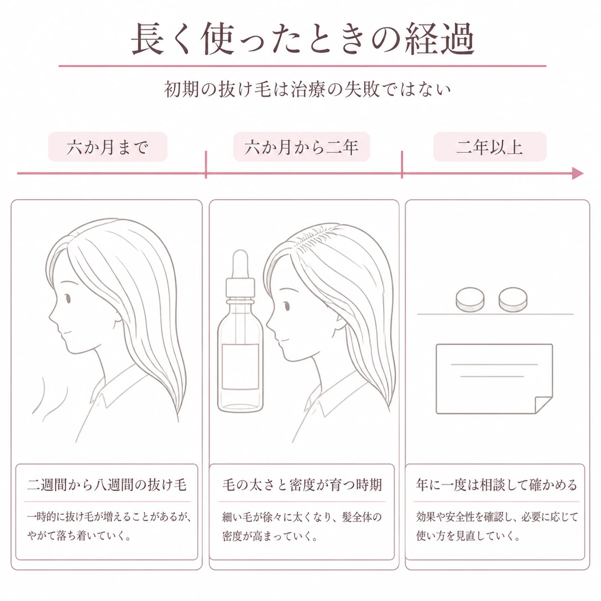 外用ミノキシジルを長く使ったときの半年ごとの経過と定期的な確認の目安を時間の帯で表したイラスト