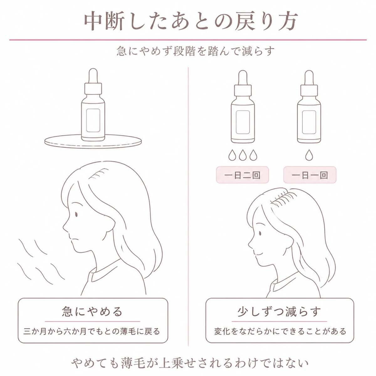 育毛剤を急にやめた場合と少しずつ減らした場合で毛量の変わり方がどう違うかを左右に分けて見比べたイラスト