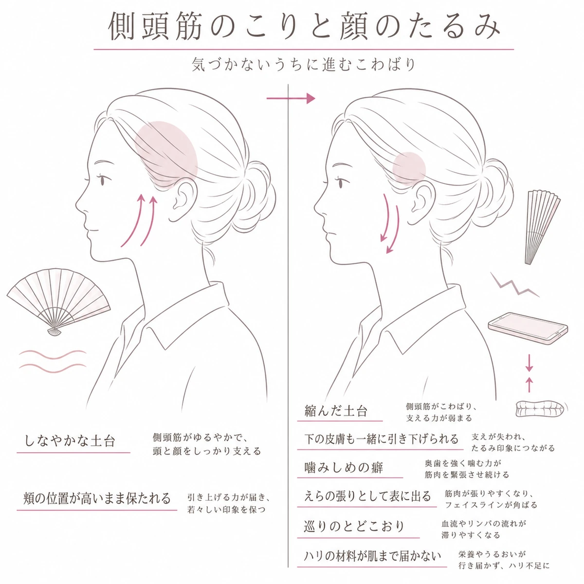 しなやかな側頭筋と硬くなった側頭筋を左右に並べ、頬の位置の違いを対比させたイラスト
