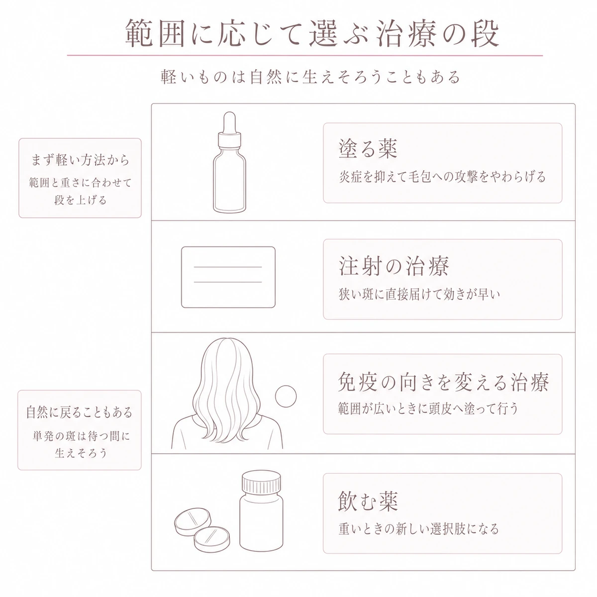 塗る薬から飲む薬まで円形脱毛症の治療の選択肢を軽いものから順に四段で示した線画イラスト