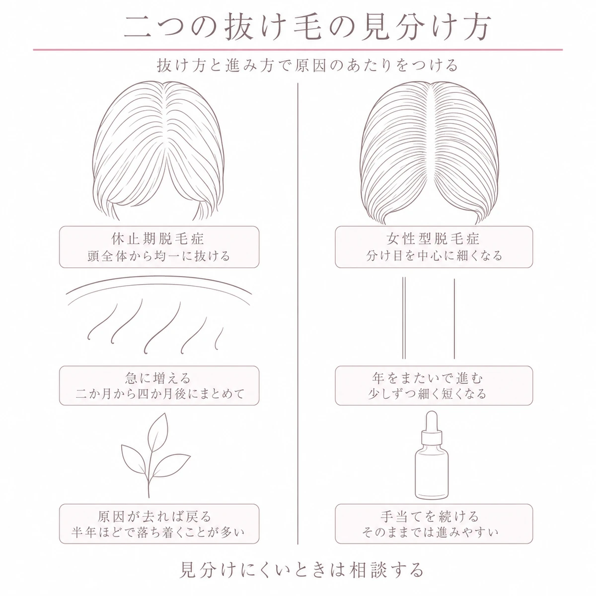 ストレス性の抜け毛と女性型脱毛症の抜け方と進み方と見通しを仕切り線の左右で比べた線画イラスト