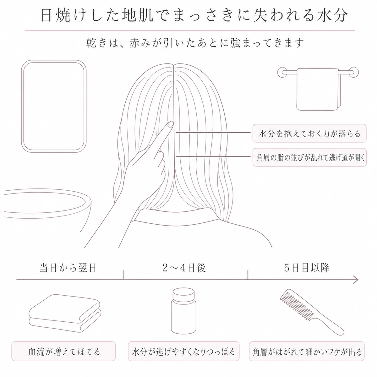 頭の分け目から水分と脂の乱れを引き出し線で示し、日焼けからの日数ごとの変化を下段に並べた図
