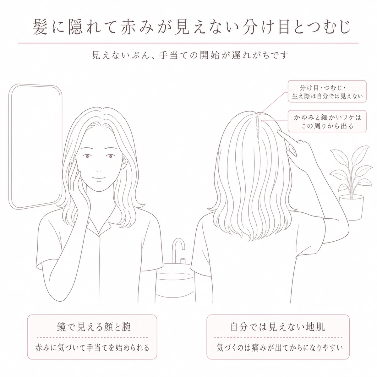 顔の赤みを確かめる女性と、分け目に指をそえた後ろ姿を左右に並べ、頭皮の気づきにくさを対にした図