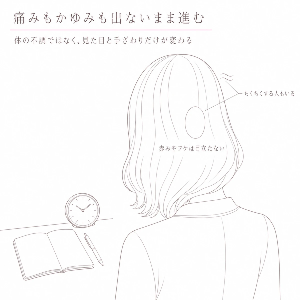 痛みもかゆみもない脱毛斑と、ちくちく感を覚える場所を描いたイラスト