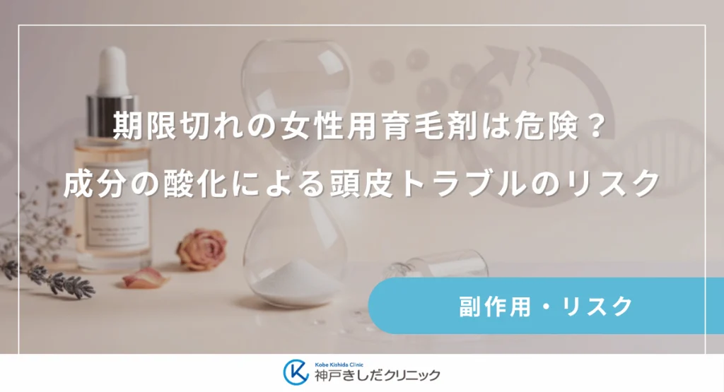 期限切れの女性用育毛剤は危険?成分の酸化による頭皮トラブルのリスクを解説