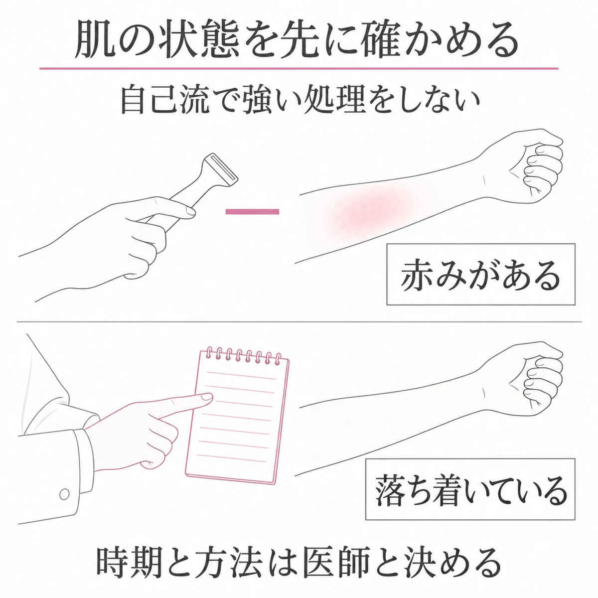 赤みがある肌では手入れを避け、落ち着いている場合も医師と方法を決めることを伝える上下の比較図