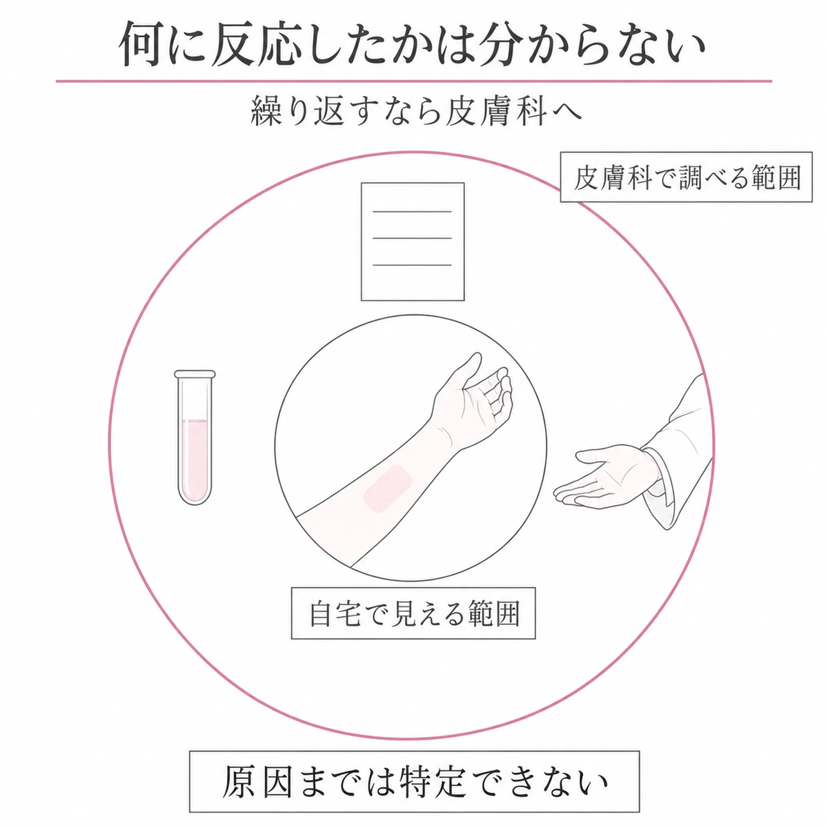自宅で確認できる皮膚の変化と、皮膚科で成分や原因を調べる範囲を同心円で区別した図