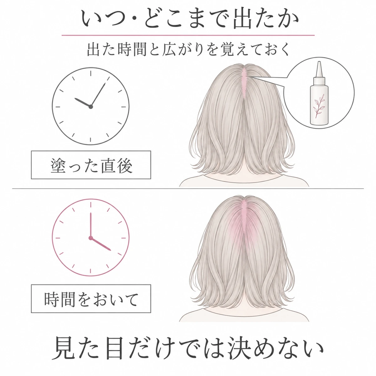 塗った直後に限られた範囲へ出る赤みと、時間をおいて広がる赤みを後頭部と時計で見比べた図