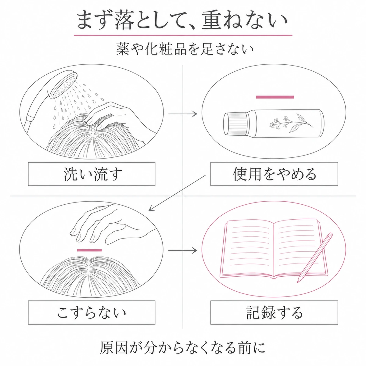 頭皮症状が出たときに洗い流し、製品の使用と刺激を避け、症状を記録するまでの対応を4区画でまとめた図