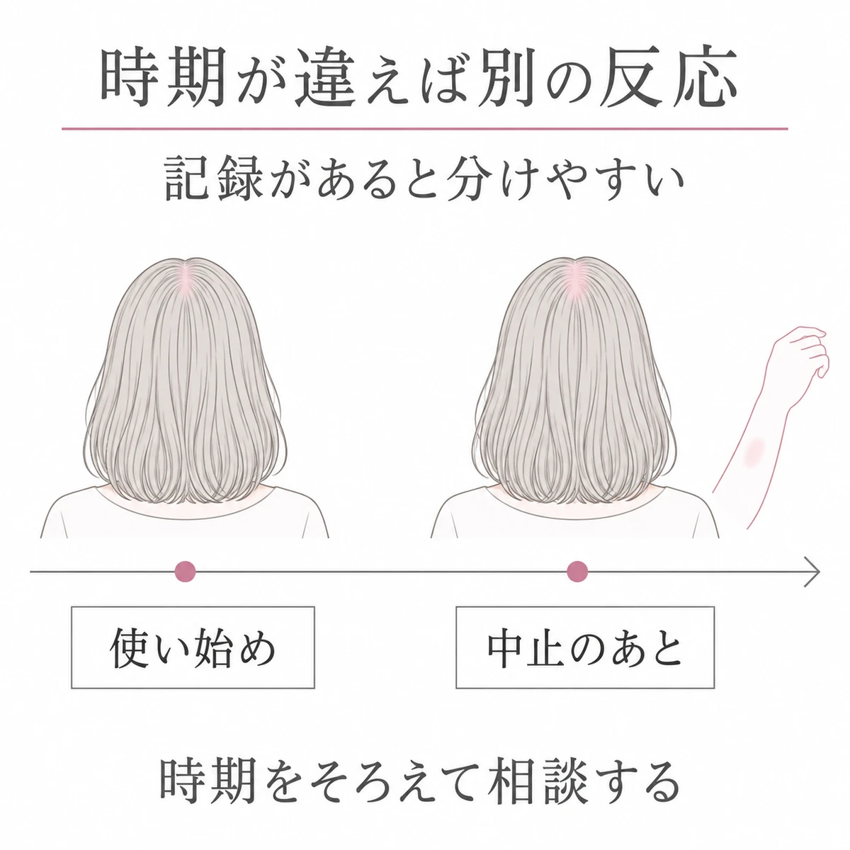 使い始めと中止後の頭髪の反応、体毛の変化を時間軸で分けた図