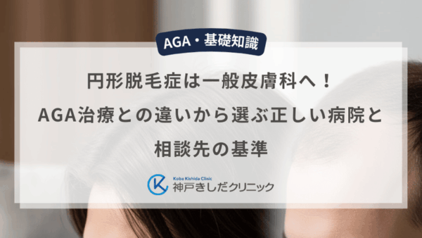 円形脱毛症は一般皮膚科へ！AGA治療との違いから選ぶ正しい病院と相談先の基準