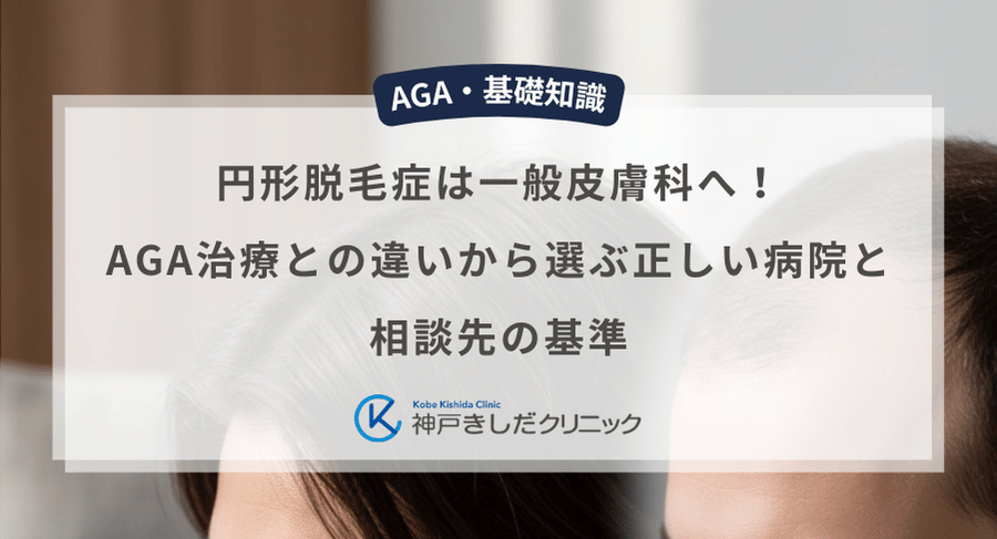 円形脱毛症は一般皮膚科へ！AGA治療との違いから選ぶ正しい病院と相談先の基準
