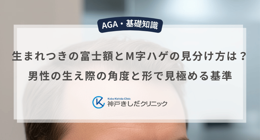 生まれつきの富士額とM字ハゲの見分け方は?男性の生え際の角度と形で見極める基準