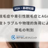 脂漏性脱毛症や牽引性脱毛症とAGAの違い｜頭皮トラブルや物理的負荷による薄毛の判別