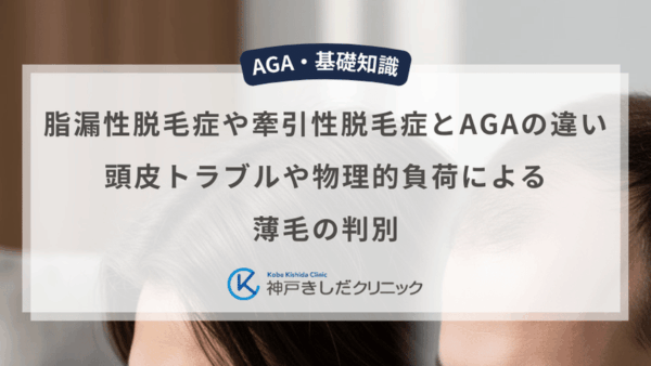 脂漏性脱毛症や牽引性脱毛症とAGAの違い｜頭皮トラブルや物理的負荷による薄毛の判別