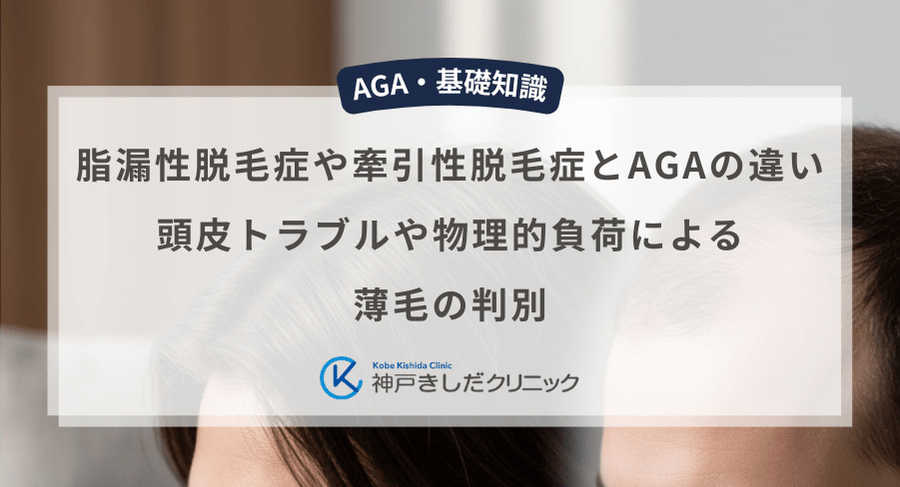 脂漏性脱毛症や牽引性脱毛症とAGAの違い|頭皮トラブルや物理的負荷による薄毛の判別