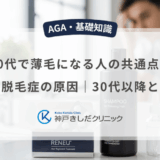 20代で薄毛になる人の共通点と若年性脱毛症の原因｜30代以降との違い