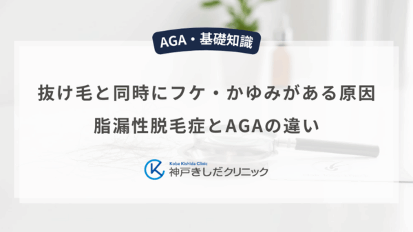 抜け毛と同時にフケ・かゆみがある原因｜脂漏性脱毛症とAGAの違い