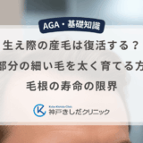 生え際の産毛は復活する？M字部分の細い毛を太く育てる方法と毛根の寿命の限界
