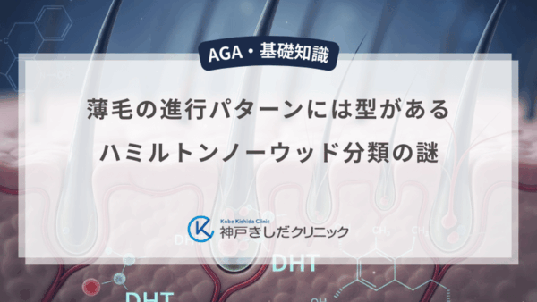 薄毛の進行パターンには型がある｜ハミルトンノーウッド分類の謎