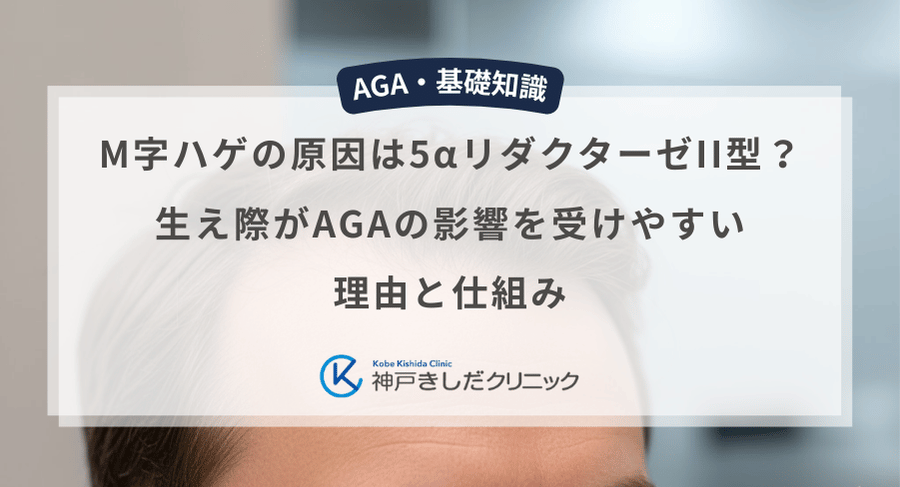 M字ハゲの原因は5αリダクターゼII型？生え際がAGAの影響を受けやすい理由と仕組み