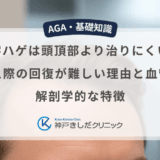 M字ハゲは頭頂部より治りにくい？生え際の回復が難しい理由と血管・解剖学的な特徴
