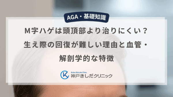 M字ハゲは頭頂部より治りにくい？生え際の回復が難しい理由と血管・解剖学的な特徴