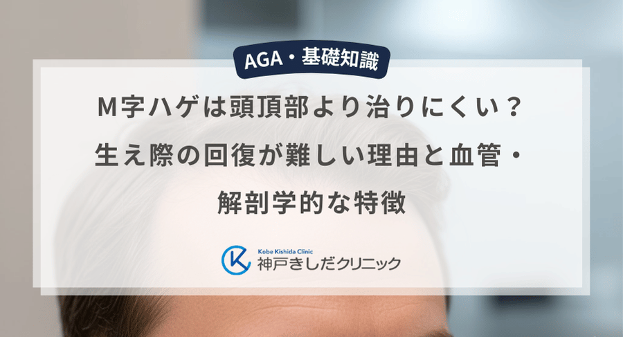 M字ハゲは頭頂部より治りにくい？生え際の回復が難しい理由と血管・解剖学的な特徴