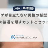 M字ハゲが目立たない男性の髪型とは？生え際の後退を隠すカットとセットのコツ