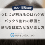 男性のつむじが割れるのはハゲの前兆？パックリ割れの原因と薄毛を目立たせない直し方