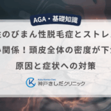 男性のびまん性脱毛症とストレスの深い関係！頭皮全体の密度が下がる原因と症状への対策