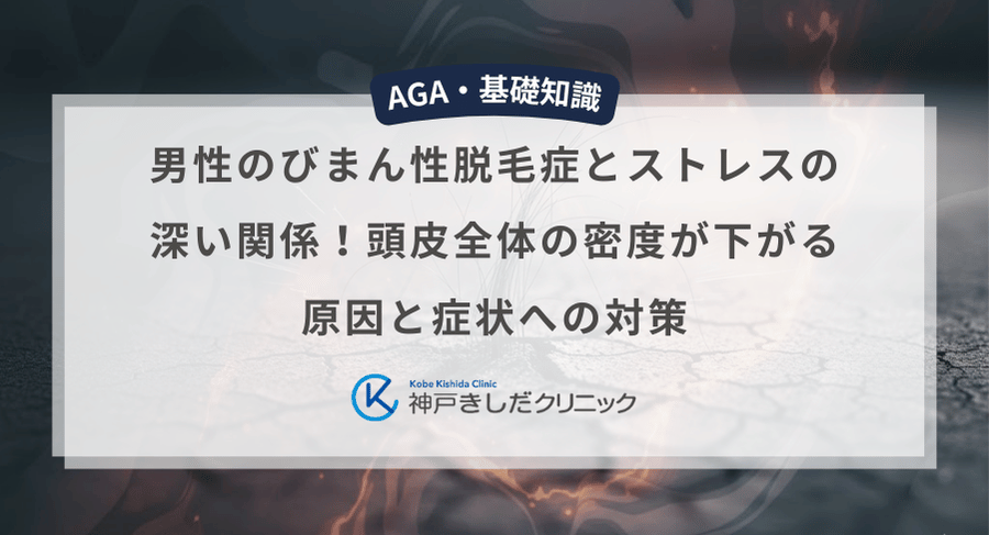 男性のびまん性脱毛症とストレスの深い関係!頭皮全体の密度が下がる原因と症状への対策