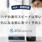 若ハゲの進行スピードは早い？手遅れになる前に気づく予兆と期間