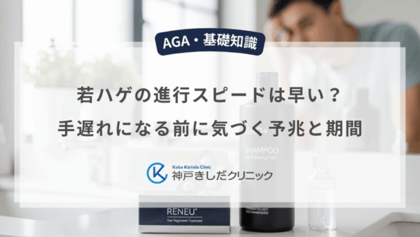 若ハゲの進行スピードは早い？手遅れになる前に気づく予兆と期間