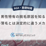 男性特有の脱毛原因を知る｜女性の薄毛とは決定的に違うメカニズム
