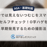 自分では見えないつむじをスマホでセルフチェック！O字ハゲを早期発見するための撮影法