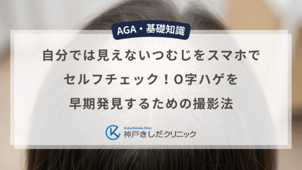 自分では見えないつむじをスマホでセルフチェック！O字ハゲを早期発見するための撮影法