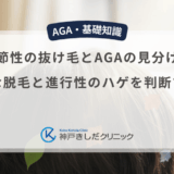 季節性の抜け毛とAGAの見分け方｜一時的な脱毛と進行性のハゲを判断する基準
