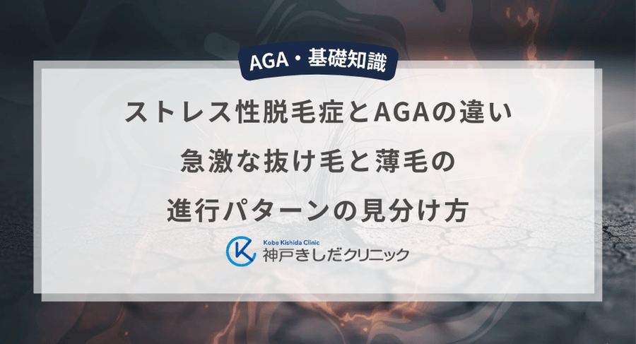 ストレス性脱毛症とAGA(男性型脱毛症)の違い|急激な抜け毛と薄毛の進行パターンの見分け方