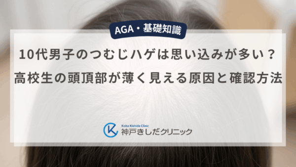 10代男子のつむじハゲは思い込みが多い？高校生の頭頂部が薄く見える原因と確認方法