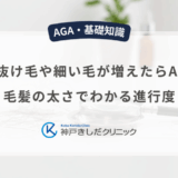 短い抜け毛や細い毛が増えたらAGA？毛髪の太さでわかる進行度