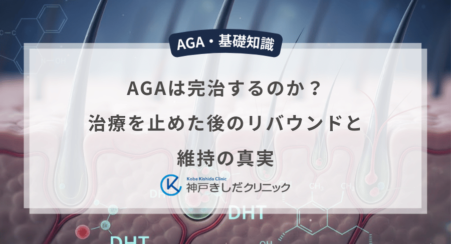 AGAは完治するのか？治療を止めた後のリバウンドと維持の真実