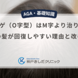 つむじハゲ（O字型）はM字より治りやすい？頭頂部の髪が回復しやすい理由と改善の目安
