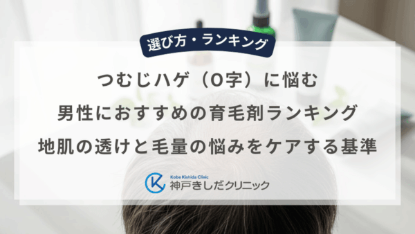 つむじハゲ（O字）に悩む男性におすすめの育毛剤ランキング｜地肌の透けと毛量の悩みをケアする基準