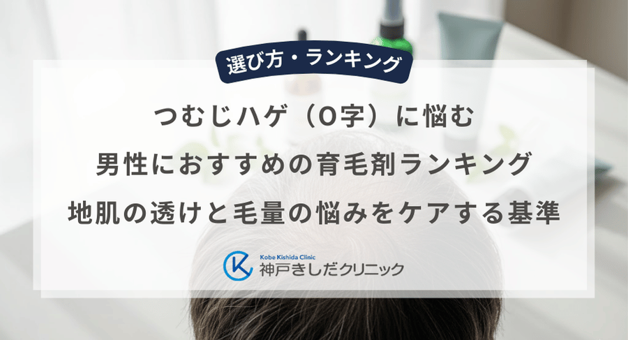 つむじハゲ(O字)に悩む男性におすすめの育毛剤ランキング|地肌の透けと毛量の悩みをケアする基準