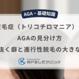 抜毛症（トリコチロマニア）とAGAの見分け方｜髪を抜く癖と進行性脱毛の大きな違い