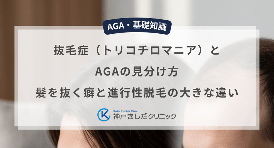 抜毛症（トリコチロマニア）とAGAの見分け方｜髪を抜く癖と進行性脱毛の大きな違い